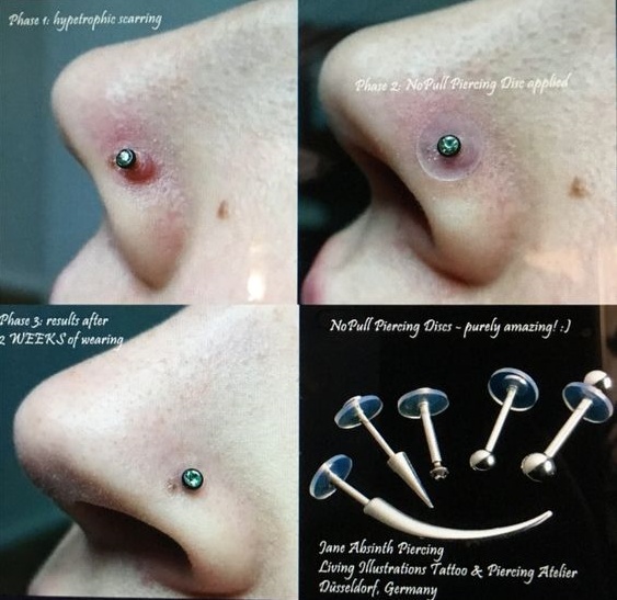 Kit para el cuidado de piercings con spray neilmed piercing aftercare y disco de silicona nopull - Imagen 2