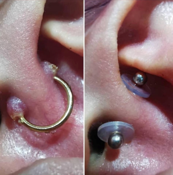 NoPull piercing Disc disco de silicona para piercings. Es un disco en silicona grado médico* el cuál ayuda en perforaciones/piercings corporales.